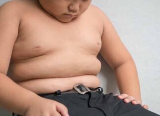 El 31% de los estudiantes dominicanos enfrenta la obesidad: un desafío nacional