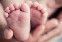 Bebé nació con un solo ojo en el centro de la cara