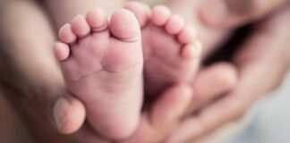 Bebé nació con un solo ojo en el centro de la cara