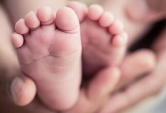 Bebé nació con un solo ojo en el centro de la cara