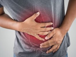 Alerta de gastroenterólogos: Diagnóstico tardío del cáncer de colon
