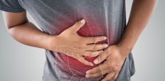 Alerta de gastroenterólogos: Diagnóstico tardío del cáncer de colon