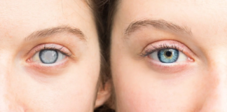 Glaucoma: La enfermedad silenciosa que roba la vista