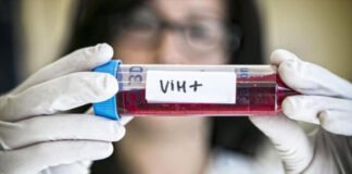 Alrededor de 4,000 casos positivos al VIH son reportados por año en el país